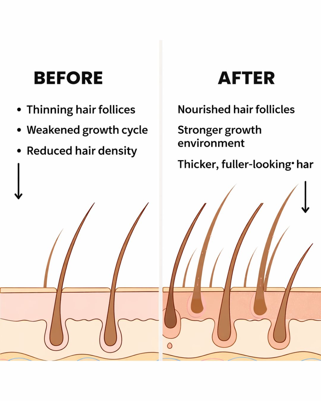 REGEN - Hairline Support Formula