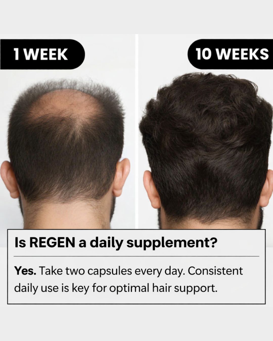 REGEN - Hairline Support Formula